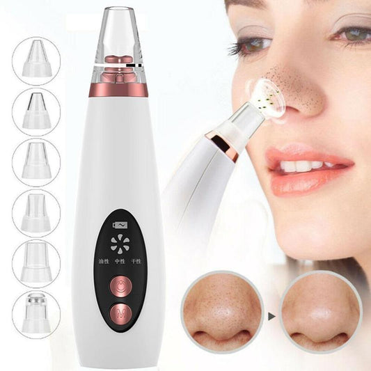Blackhead Pore Vacuum Cleaner and Remover Button Face Suction